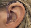 Достоинства заушных слуховых аппаратов